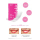 SmileKit Pap+ Teeth whitening strips, 28 pcs